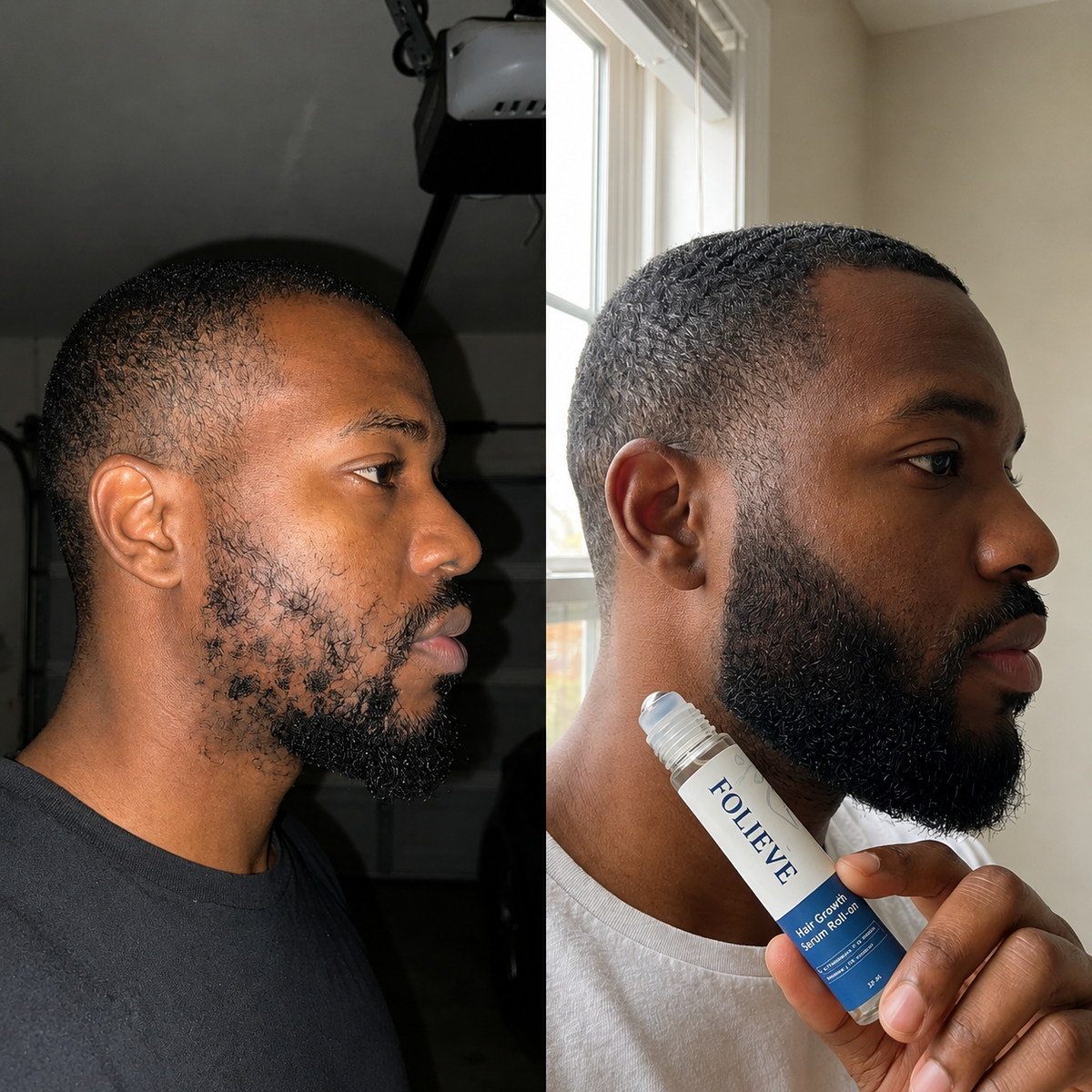 FOLIEVE Beard Growth Roll on Serum